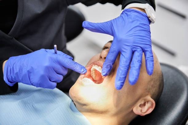 Best Emergency Tooth Extraction in Marion, MS