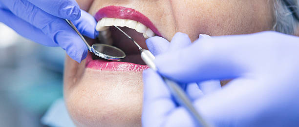 Best Emergency Wisdom Teeth Removal in Marion, MS